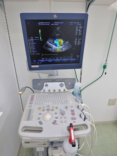 超音波（エコー）検査装置